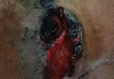 Рваная рана коленной складки и паха, на приёме